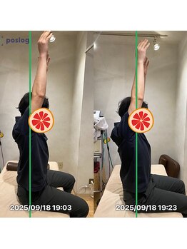 グレフル鍼灸接骨院 整体院 心斎橋/整体/肩こり/マッサージ/腰痛