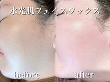 話題のフェイスワックス導入サロン！水光肌で素肌をキレイに！