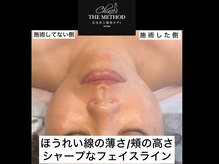 サザンベル(Southern Belle)/ChinoTHEMETHOD【美骨フェイス】