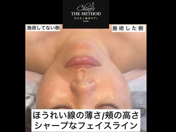 サザンベル(Southern Belle)/ChinoTHEMETHOD【美骨フェイス】