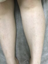 ナノハナ/鹿沼市本格脱毛の美容室ナノハナ