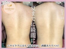 ハーバリー ハーブピーリング 大阪梅田店(HERBERRYハーブピーリング)/梅田ハーブピーリングHERBERRY