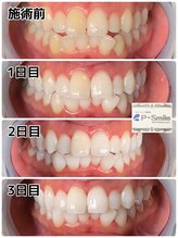 ホワイトベース(White Base)/お客様の施術後