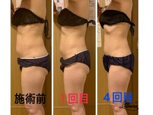 ビューティスペースグリッター(beauty space Glitter)/インド式全身オイルマッサージ