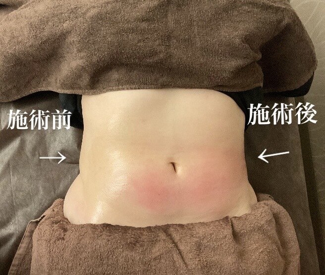 エックス シェイプ(X-shape)｜ホットペッパービューティー