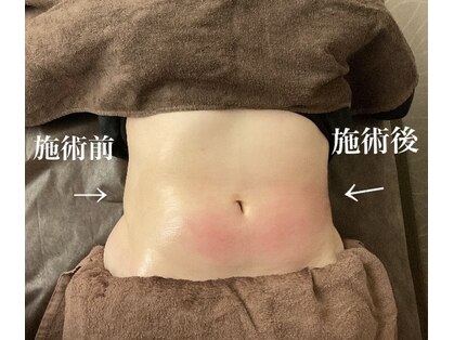 エックス シェイプ(X-shape)の写真