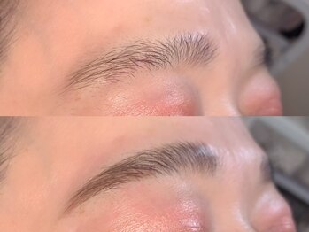 エルミュ(Elmu)/ハリウッドブロウリフト