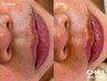 【顔WAX脱毛】古い角質も産毛も一度でツルリン♪肌に優しい顔WAX◎8500→7000