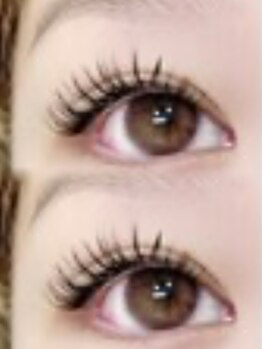 リラックスアンドビューティーサロン グロー(GLOW)/バインドロック100束