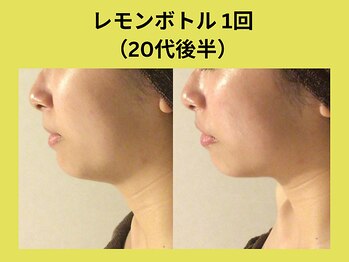 リンク 錦糸町店(Link)/レモンボトル1回