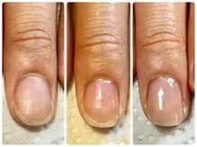 スターネイル(Starnail)の雰囲気（★美爪美人に左から右へ変化する爪育成綺麗になると自信がつく）