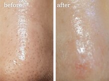 メルシア(merucia)/