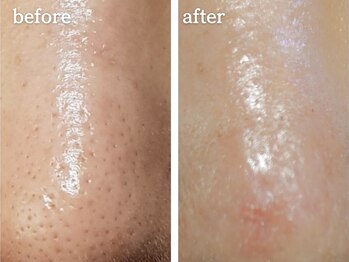 メルシア(merucia)/