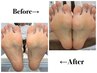 【夏季限定】foot角質ケア¥3500