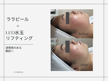 フォルディオ(FORDIO)の写真