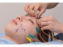 いとしまリハキュア整骨院/美容はり