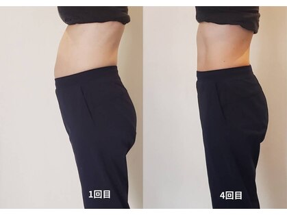 ヨモギ蒸スメの写真