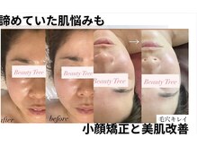 ビューティーツリー(Beauty Tree)