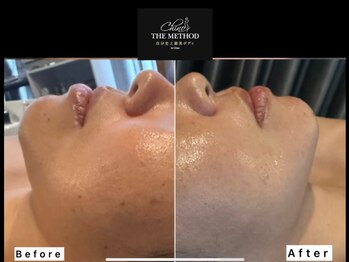 サザンベル(Southern Belle)/ChinoTHEMETHOD【美骨フェイス】