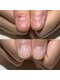 アティックネイルアトリエ(attic nail atelier)の写真/【深爪&美爪育成】圧倒的な技術力で、本来の美しさを取り戻す究極の自爪育成ケア★完全個室で相談しやすい