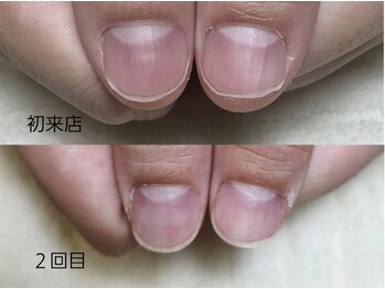 グラシナ 名古屋金山店/(深爪／長さだし/フィルイン)