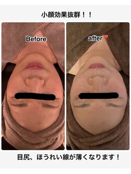 サロン ド エム(Salon du Em)/フェイシャル小顔トリートメント