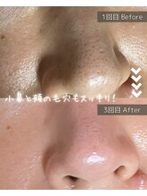 ザ プレザント 大倉山(the pleasant)/クリスティーナのビオフィート