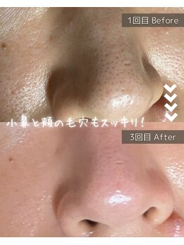 ザ プレザント 大倉山(the pleasant)/クリスティーナのビオフィート