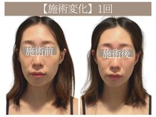 ドクターボディ 恵比寿店(Dr.Body)/【顔の歪み身体から改善 30代】