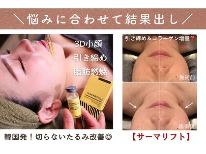 ウミン(UMIN)の写真