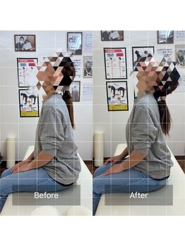 ナオル整体 福島院(naoru整体)/30代女性