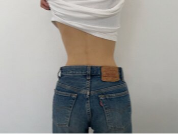 トリア(Tria.)の写真/くすみの原因の産毛、脱毛の「残り毛」改善！県内希少な顔からボディまで毛穴レスつるんと美肌へ○