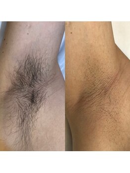 メンズプシュケ(men's PSYCHE)/