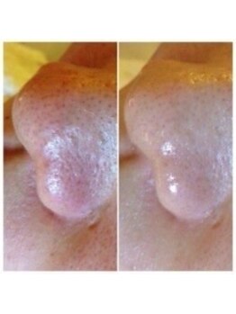 肌屋(HADA-YA)/ツヤ肌強力洗浄★毛穴リメイク