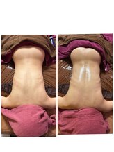 ビマリア(美-MARIA)/デトックス美BODY 痩身