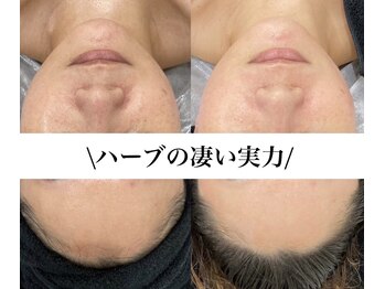 アンク(Ankh)/ハーブトリートメントの凄い実力