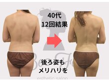 ビーフォー(be for)/40代　12回結果♪