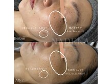ナデカ(NADEKA)の雰囲気（効果出しに自信のあるサロン！症例多数。）