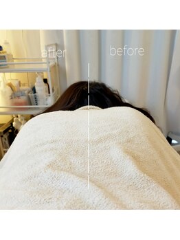 ミールーム(mi room)/筋骨マッサージ(整体)