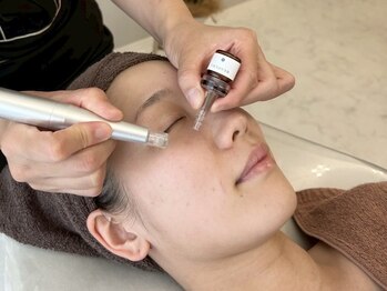 ソラリス(solaris)の写真/【SNSで話題★】エステダーマ×脂肪燃焼剤レモンボトルで美肌＆小顔！二重アゴ/フェイスラインのもたつき◎