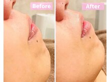 銀座八/本格レディースシェービング効果