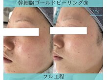 リメイククリニカルビューティー(Remake clinical beauty)/