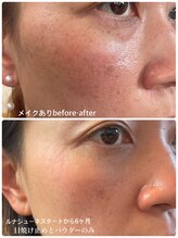 ペリドット(Peridot)/ルナシューネ化粧品