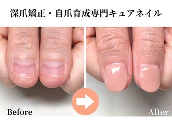キュアネイル(Qa Nail)
