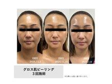 モイ(Moi’e)/くすみ・たるみ・毛穴・ツヤ肌