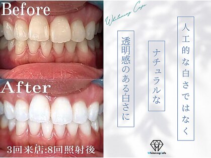 ホワイトニングカフェ 金山店(WhiteningCafe)の写真
