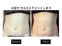 ナチュラーレ 天王寺店(Naturale)/痩身美脚リンパマッサージ二の腕