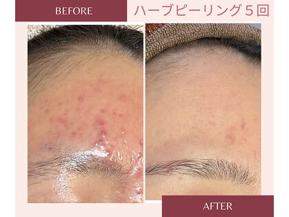 アブニールブリヨンの写真