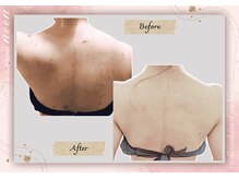 ヌーン(noon)/痩身しながら背中も綺麗に