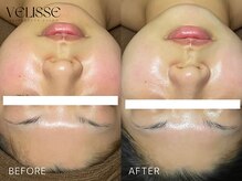 ヴェリス 福岡店(Velisse)/